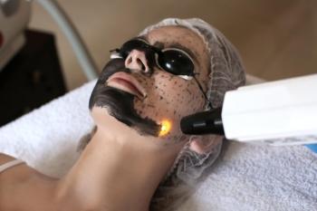 CARBON PEELING (ANTIAGING - SKIN RELIEF - STAIN TREATMENTS)