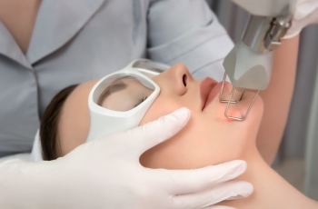 SKIN REJUVENATION WITH LASERS