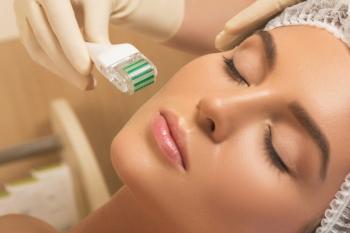 DERMAROLLER-DERMAPEN (MICRO NEEDLING) TREATMENTS