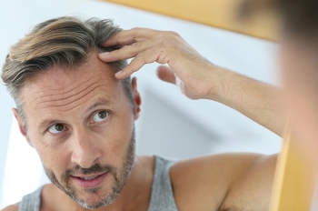 WHAT ARE FUE HAIR TRANSPLANT TECHNIQUES?