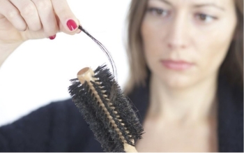 AUTOLOGISCHE MIKROGRAFT-METHODE BEI MÄNNLICHEM HAARVERLUST / REGENERA ACTIVA / G-ZELLE