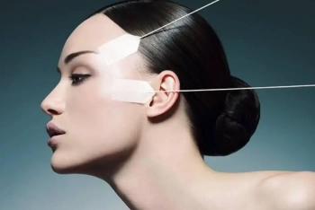 WAS IST EIN HAUTLIFTING MIT POLY-CAPROLACTON-FÄDEN (SEMI-PERMANENT)?