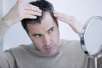 معلومات عامة عن زراعة الشعر