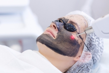 التقشير الكربوني (مضاد للتجاعيد - تهدئة البشرة - معالجة البقع)